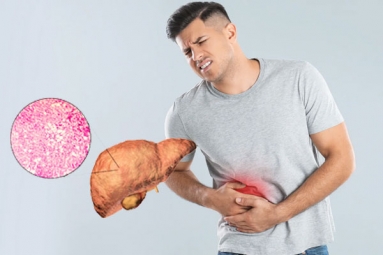 Fatty Liver can be Reversed in Just One Month