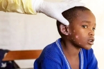 Monkeypox Outbreak latest, Monkeypox Outbreak breaking, is monkeypox outbreak coming to india, Monkeypox