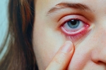 Conjunctivitis treatment, Conjunctivitis prevention, special measures to prevent conjunctivitis, Conjunctivitis