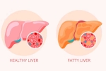 Grade 2 Fatty Liver medication, Grade 2 Fatty Liver, how to reverse grade 2 fatty liver, Sp s win Grade 2 Fatty Liver medication, Grade 2 Fatty Liver, how to reverse grade 2 fatty liver, Sp s win