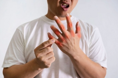 Why joint pains become Worse in Monsoon?