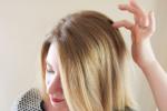 hair loss., Remedies, remedies to get rid of itchy scalp, Itchy scalp hair loss., Remedies, remedies to get rid of itchy scalp, Itchy scalp