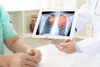 Suggested Lifestyle Changes to Improve Your Lung Health Suggested Lifestyle Changes to Improve Your Lung Health